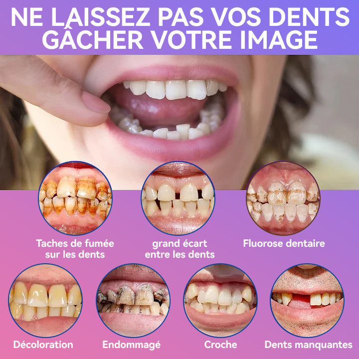 𝐉𝐚𝐬𝐬𝐞𝐞𝐦® Dernières Prothèses Dentaires Premium Confort🎉 (Prothèses haut de gamme, Confortables à Porter - Remise de 70% pour une durée limitée)🔥