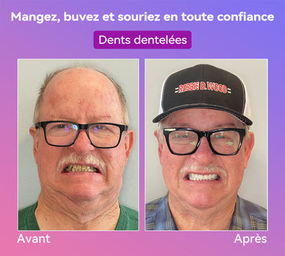 𝐉𝐚𝐬𝐬𝐞𝐞𝐦® Dernières Prothèses Dentaires Premium Confort🎉 (Prothèses haut de gamme, Confortables à Porter - Remise de 70% pour une durée limitée)🔥