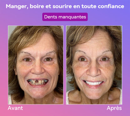 𝐉𝐚𝐬𝐬𝐞𝐞𝐦® Dernières Prothèses Dentaires Premium Confort🎉 (Prothèses haut de gamme, Confortables à Porter - Remise de 70% pour une durée limitée)🔥