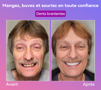 𝐉𝐚𝐬𝐬𝐞𝐞𝐦® Dernières Prothèses Dentaires Premium Confort🎉 (Prothèses haut de gamme, Confortables à Porter - Remise de 70% pour une durée limitée)🔥