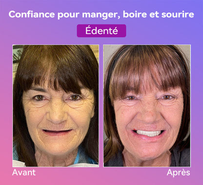 𝐉𝐚𝐬𝐬𝐞𝐞𝐦® Dernières Prothèses Dentaires Premium Confort🎉 (Prothèses haut de gamme, Confortables à Porter - Remise de 70% pour une durée limitée)🔥