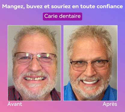 𝐉𝐚𝐬𝐬𝐞𝐞𝐦® Dernières Prothèses Dentaires Premium Confort🎉 (Prothèses haut de gamme, Confortables à Porter - Remise de 70% pour une durée limitée)🔥